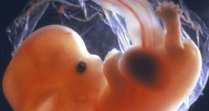 feto bambino